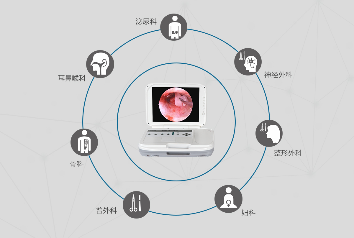 內(nèi)窺鏡攝像機(jī)的應(yīng)用領(lǐng)域有哪些？