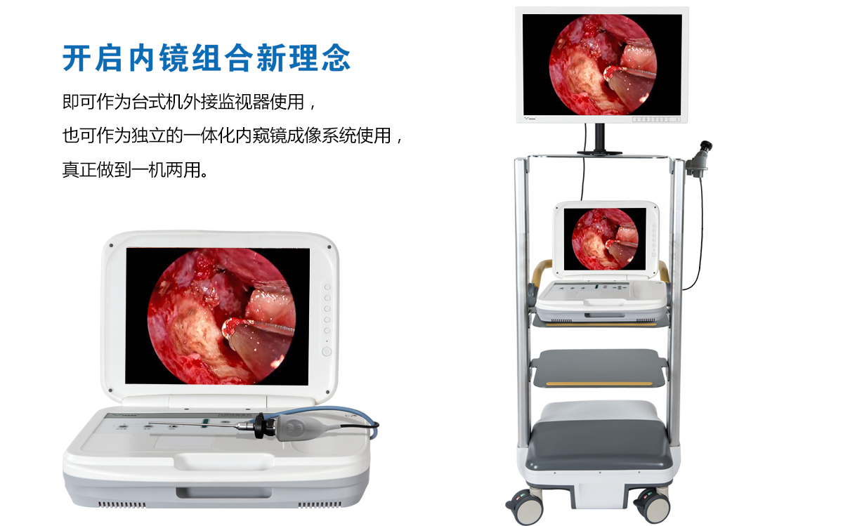 用戶反饋：YKD-9003內(nèi)窺鏡攝像機獲得好評