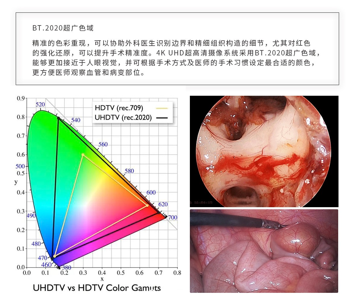 【4K醫(yī)用內(nèi)窺鏡攝像系統(tǒng)】您的第一臺“4K”找到了嗎？