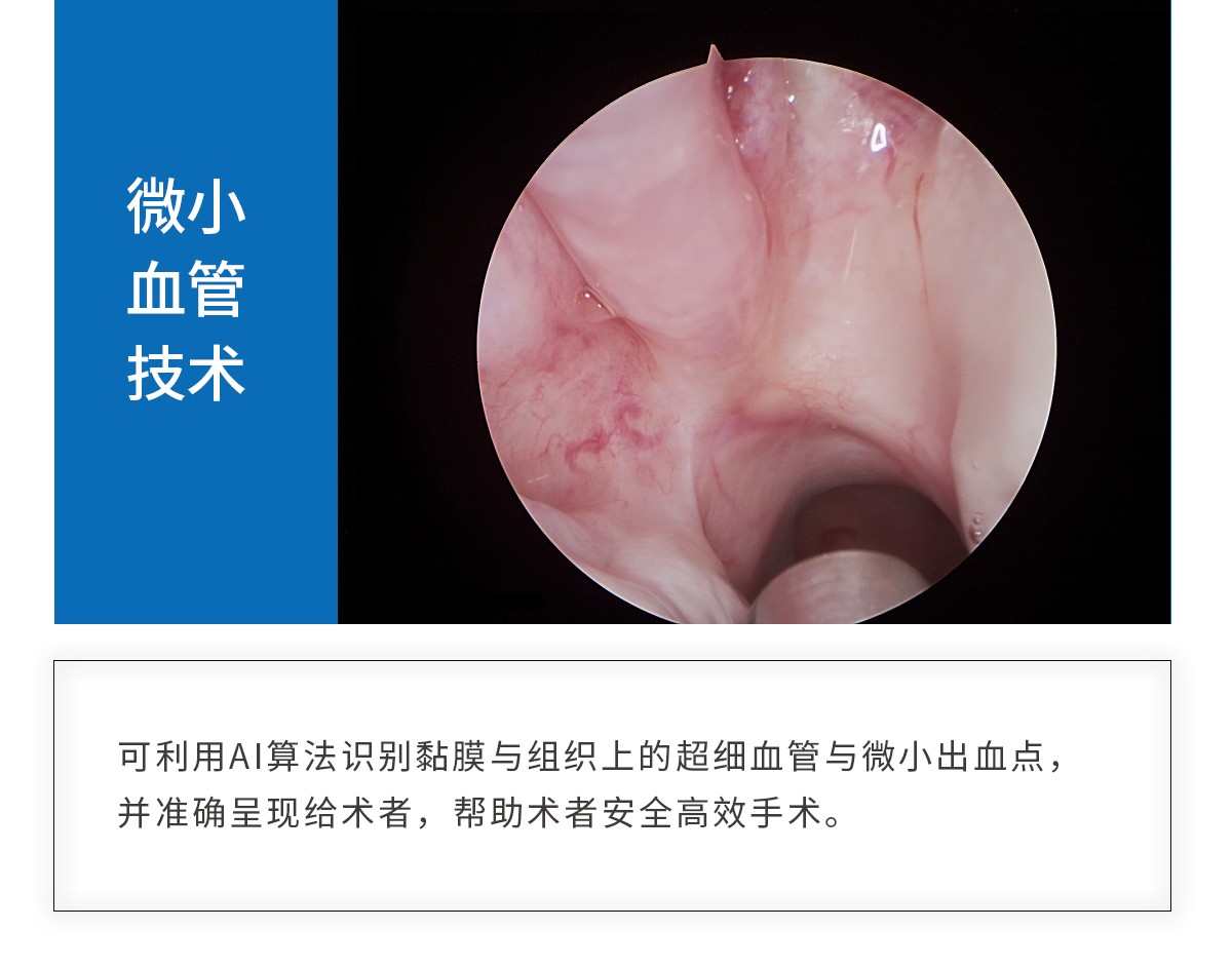 【4K醫(yī)用內(nèi)窺鏡攝像系統(tǒng)】您的第一臺“4K”找到了嗎？