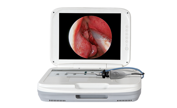 鼻內窺鏡是檢查什么的？需要注意哪些？